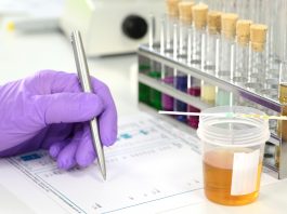 Urinprobe im Labor mit Urinteststreifen