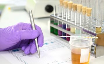 Urinprobe im Labor mit Urinteststreifen