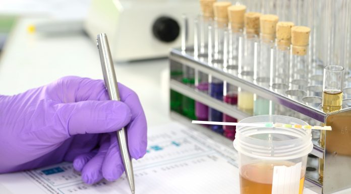 Urinprobe im Labor mit Urinteststreifen