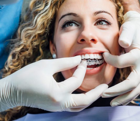 Doktor mit weißen Handschuhen setzt einer Frau eine Invisalign Schiene ein.
