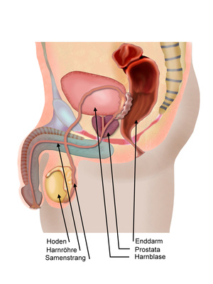 prostata entzündung symptome