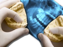 Oralchirurgische Eingriff bei Weisheitszähnen