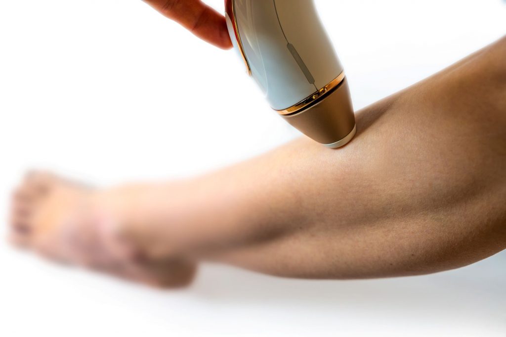 Frau wendet ein IPL-Gerät zur dauerhaften Haarentfernung am Unterschenkel an. Nahaufnahme der Behandlung, Fokus auf Haut und Handgerät für glatte, haarfreie Beine.