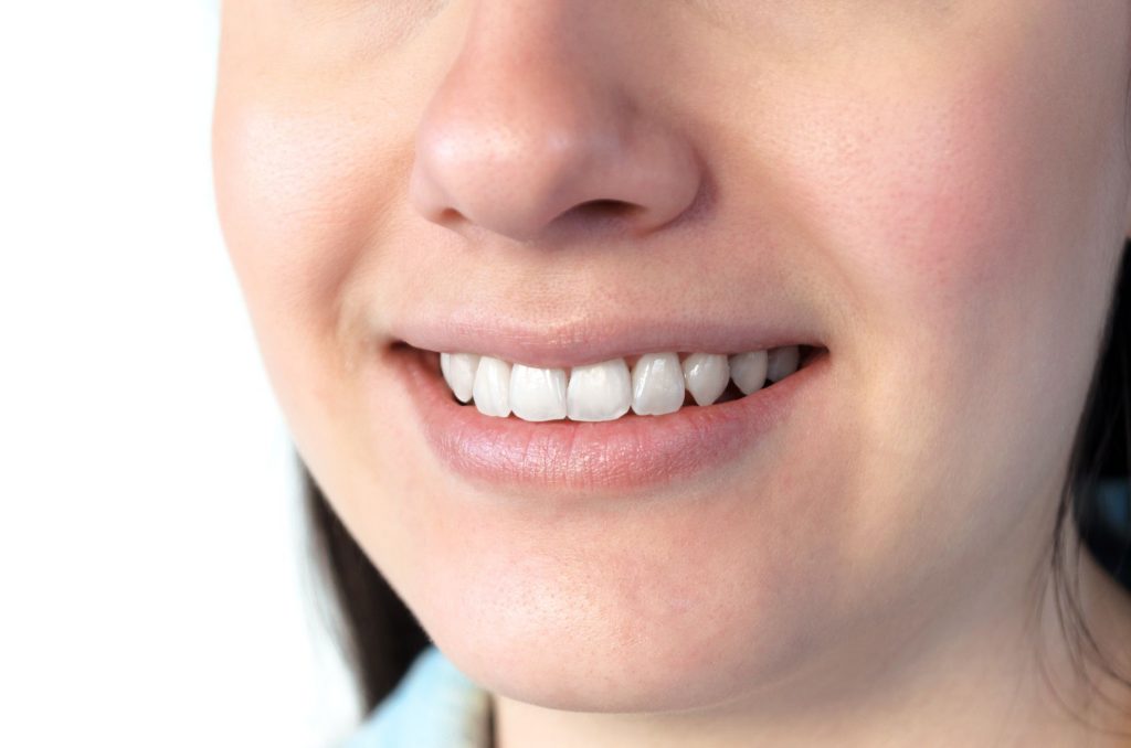 Nahaufnahme eines lächelnden Mundes mit weißen, gepflegten Zähnen und gesundem Zahnfleisch; zeigt ein natürliches Lächeln und dient zur Veranschaulichung von Mundgesundheit und guter Mundhygiene.