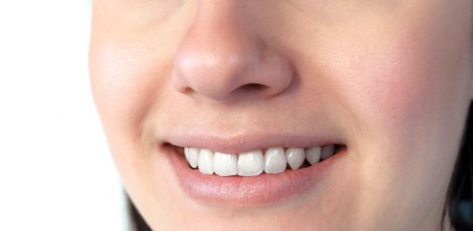 Nahaufnahme eines lächelnden Mundes mit weißen, gepflegten Zähnen und gesundem Zahnfleisch; zeigt ein natürliches Lächeln und dient zur Veranschaulichung von Mundgesundheit und guter Mundhygiene.