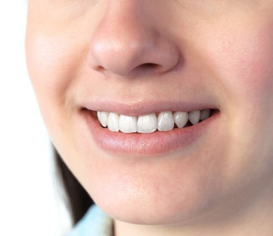 Nahaufnahme eines lächelnden Mundes mit weißen, gepflegten Zähnen und gesundem Zahnfleisch; zeigt ein natürliches Lächeln und dient zur Veranschaulichung von Mundgesundheit und guter Mundhygiene.