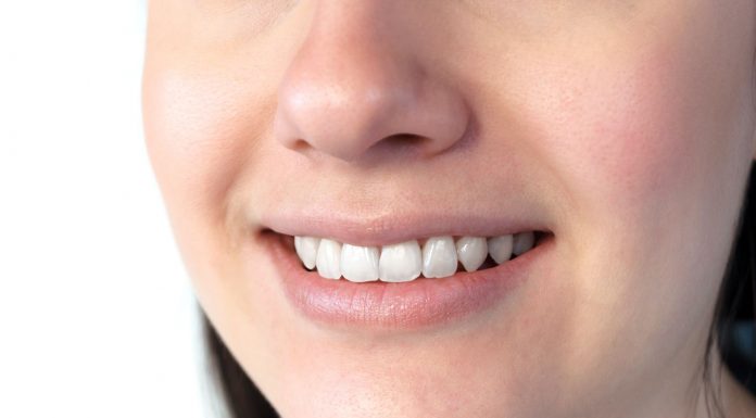 Entzündungen im Mund: Ursache Mundhygiene? Nahaufnahme eines lächelnden Mundes mit weißen, gepflegten Zähnen und gesundem Zahnfleisch; zeigt ein natürliches Lächeln und dient zur Veranschaulichung von Mundgesundheit und guter Mundhygiene.